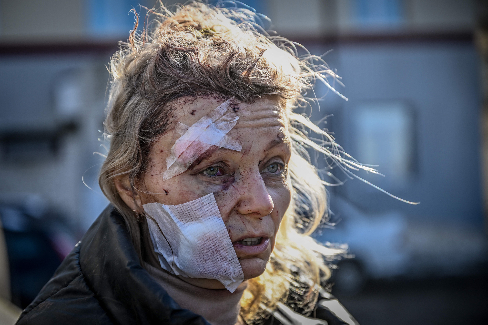 Olena Kurylo, a 52-year-old teacher, stands outside a hospital after the February 24 bombing of the town of Chuguiv in eastern Ukraine.